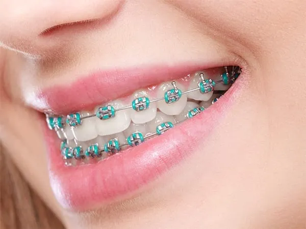 Orthodontics category image